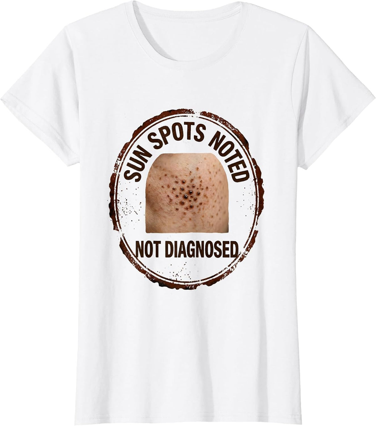 Women's Sun Spots Noted Not Diagnosed Funny Esthetician Skincare T-Shirt - White