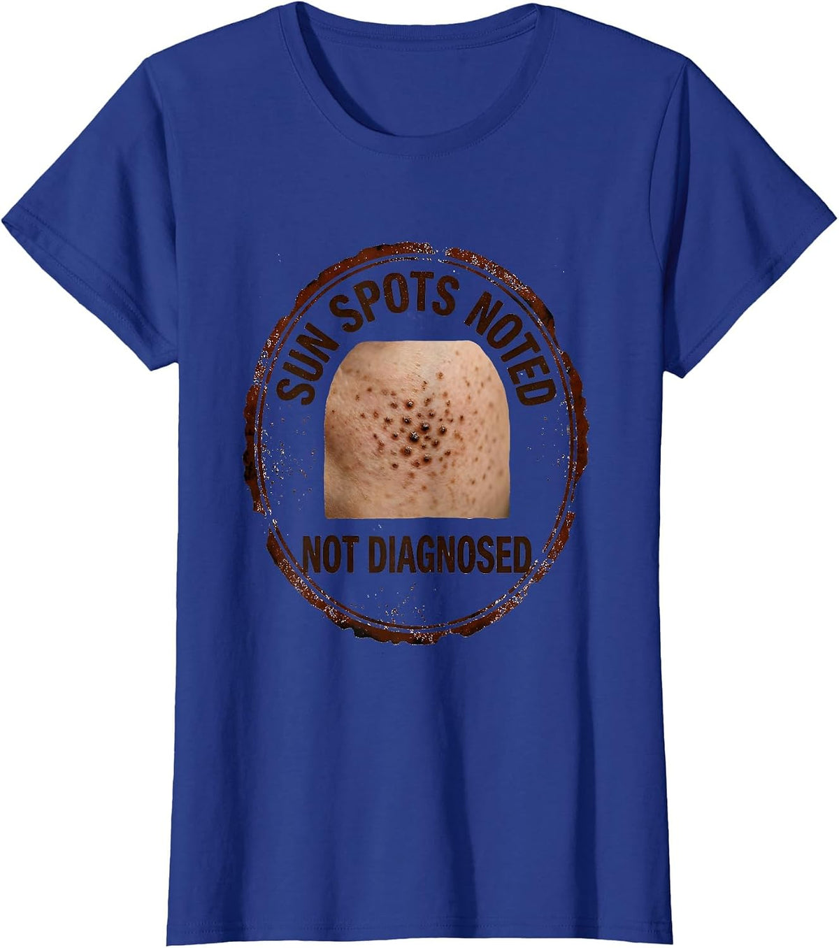 Women's Sun Spots Noted Not Diagnosed Funny Esthetician Skincare T-Shirt - Royal Blue