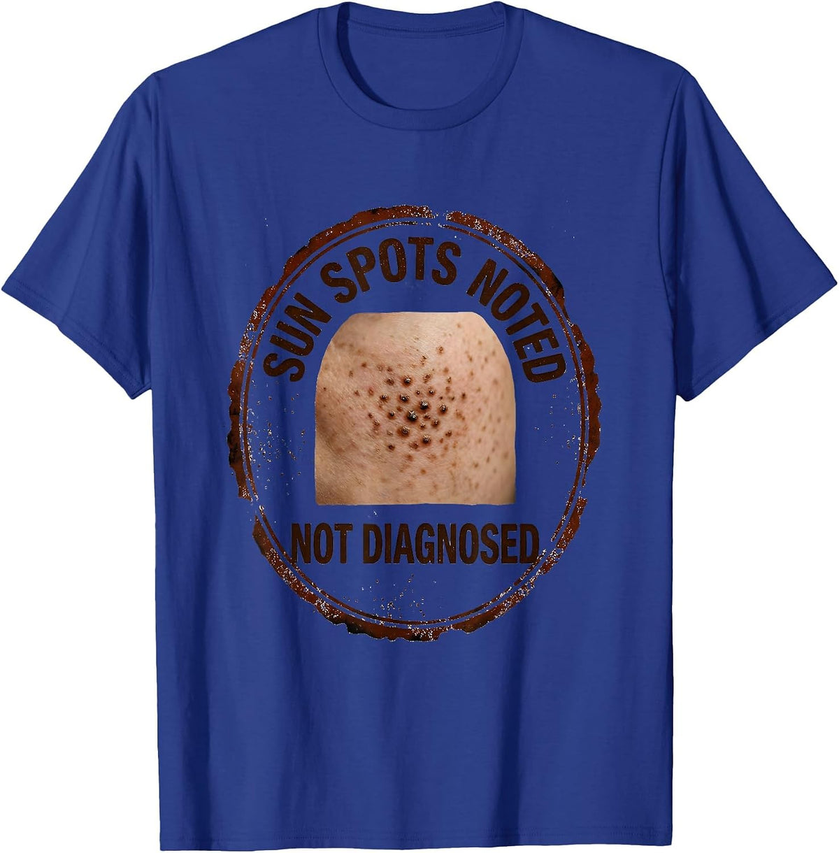 Men's Sun Spots Noted Not Diagnosed Funny Esthetician Skincare T-Shirt - Royal Blue