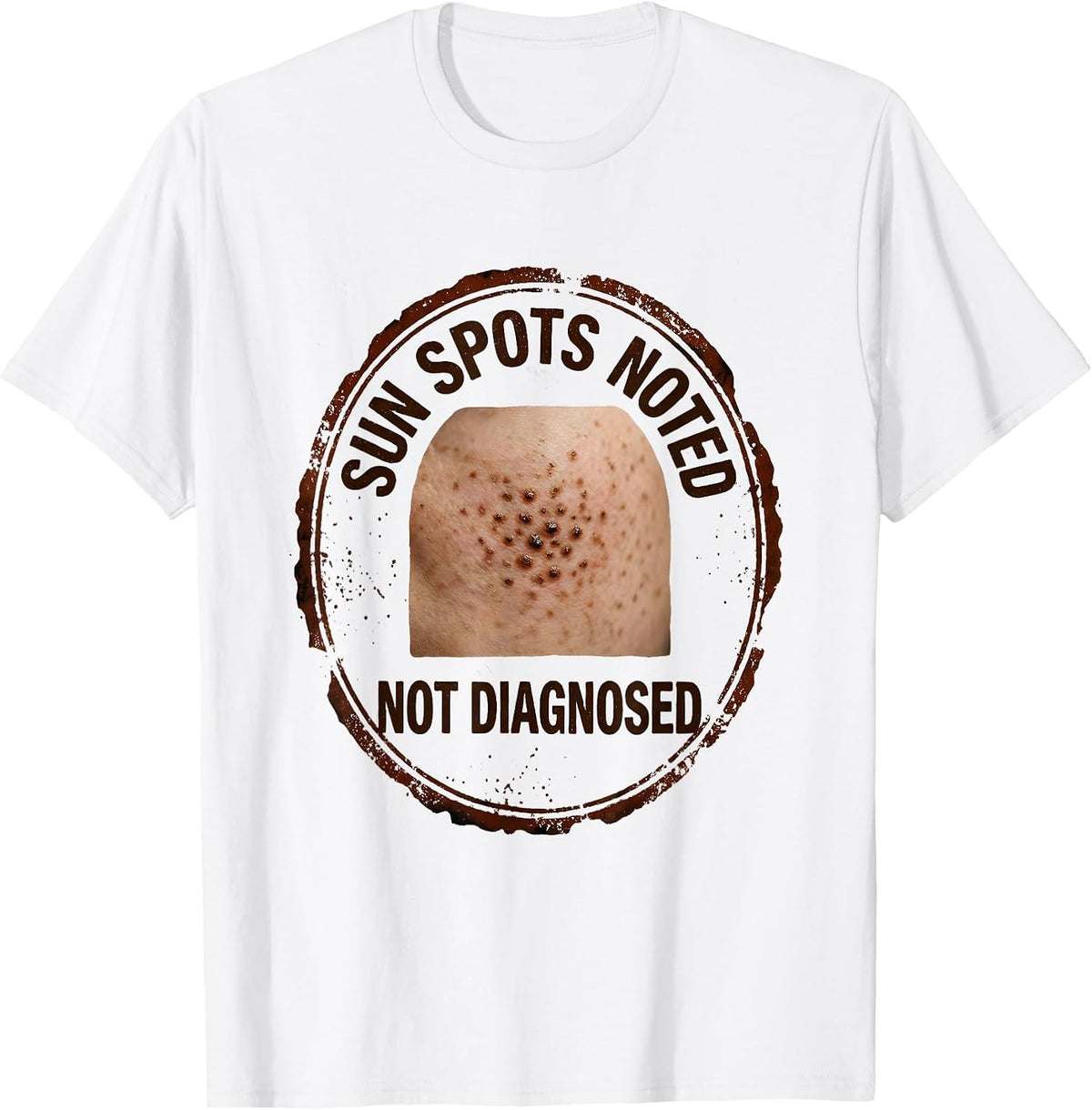 Men's Sun Spots Noted Not Diagnosed Funny Esthetician Skincare T-Shirt - White